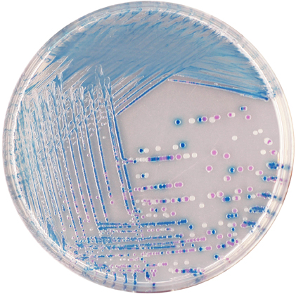 EZ-CHROM E. coli O157